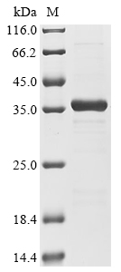 CSB-EP001324HU