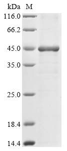 CSB-EP002160HU