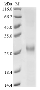 CSB-EP006185HU1e1