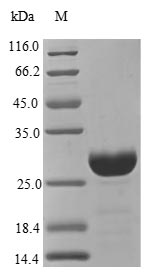 CSB-EP006204HU