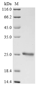 CSB-EP007587HUe1