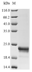 CSB-EP007946HU