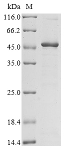 CSB-EP011867HU1