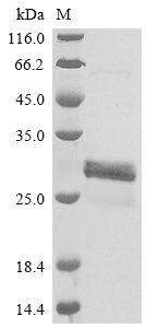 CSB-EP021081HU1e0