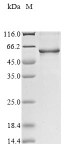CSB-EP025944HU