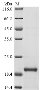 CSB-EP614514HUd7