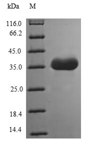 CSB-EP818263HUa0
