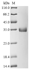 CSB-EP896521HU