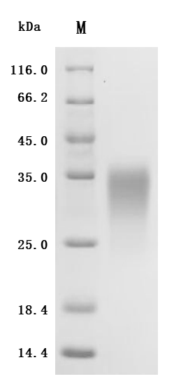 CSB-MP001260HU1