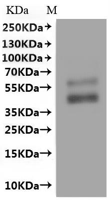 CSB-MP001391HU(A4)