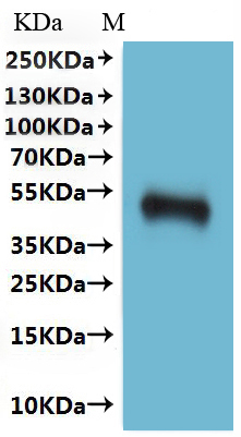 CSB-MP004844HU