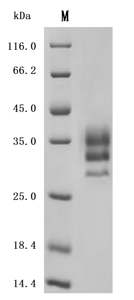 CSB-MP6176MOV