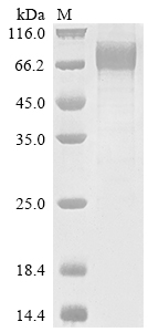 CSB-MP621688HU
