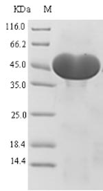 CSB-EP001158HU