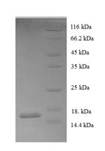 CSB-EP006519HU
