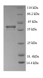 CSB-EP012164HU