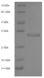 CSB-EP012467HU