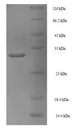 CSB-EP017621HU