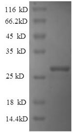 CSB-EP019557HU