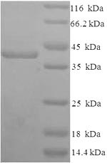 CSB-EP020888HU