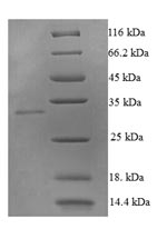 CSB-EP023985HU