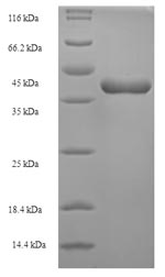 CSB-EP023987HU