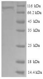 CSB-EP025809HU