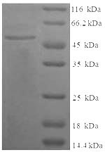 CSB-EP313364HU