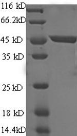CSB-EP751251HU