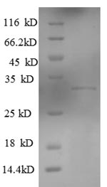 CSB-EP846610HU