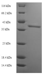 CSB-EP848825HU