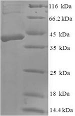 CSB-EP866207HU