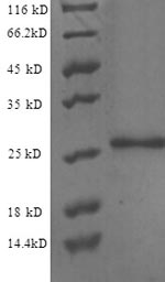 CSB-EP892160HU