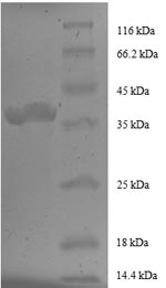 CSB-EP008691HU1