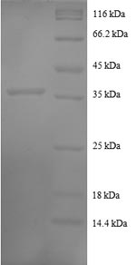 CSB-RP059654h