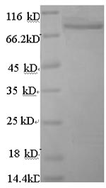 CSB-EP866314HU1