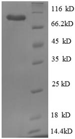 CSB-EP010814HU1
