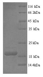 CSB-YP008434HU