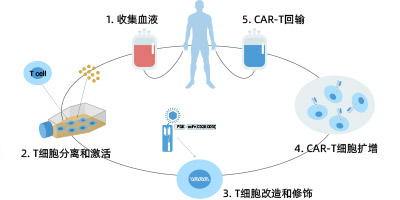 CAR-T細(xì)胞治療開發(fā)解決方案