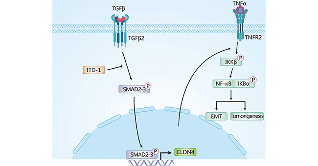 CLDN4誘導(dǎo)膠質(zhì)瘤細(xì)胞EMT途徑
